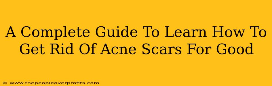 A Complete Guide To Learn How To Get Rid Of Acne Scars For Good